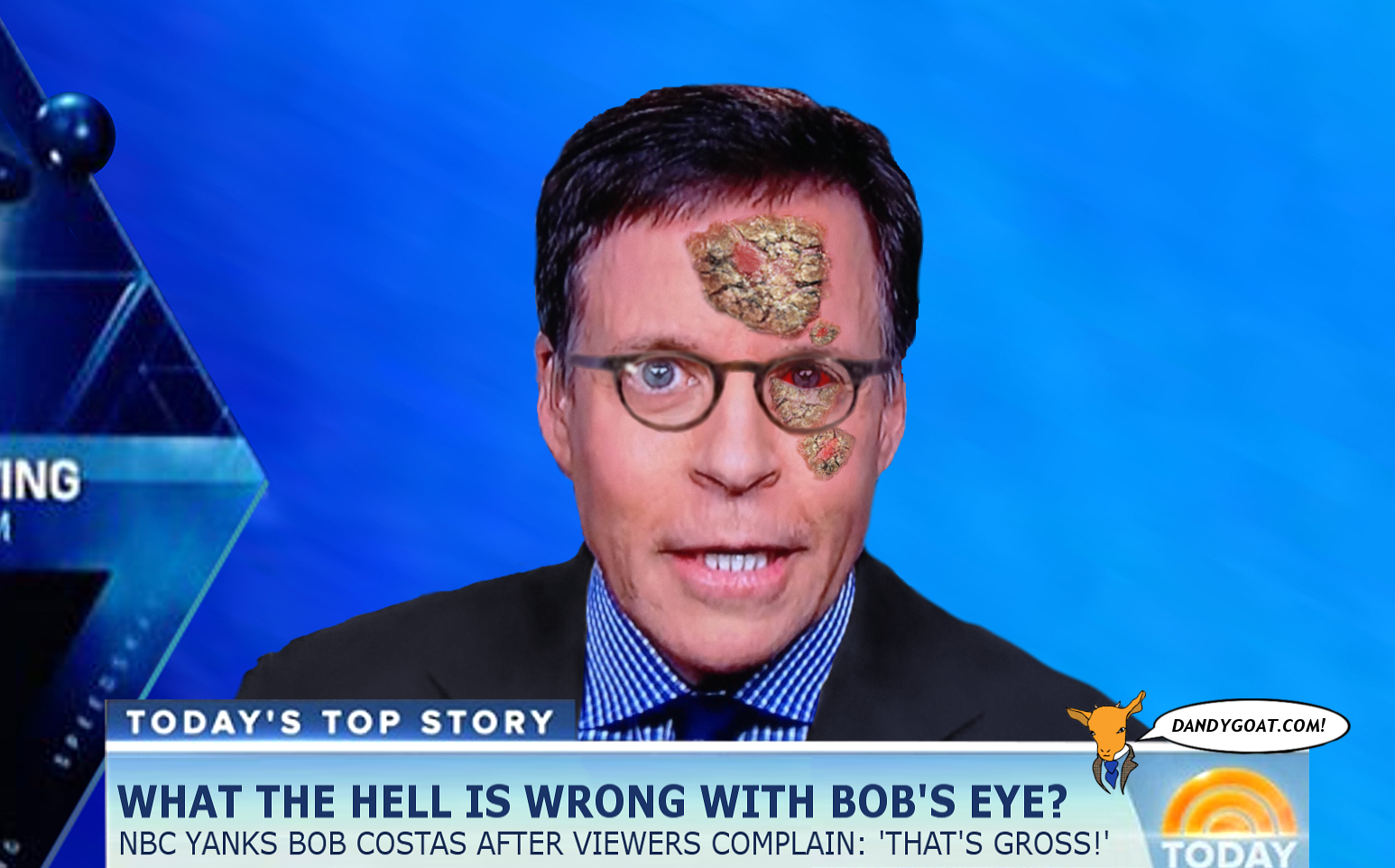 Bob Costas’ mysterious eye infection disgusts NBC viewers - Dandy Goat